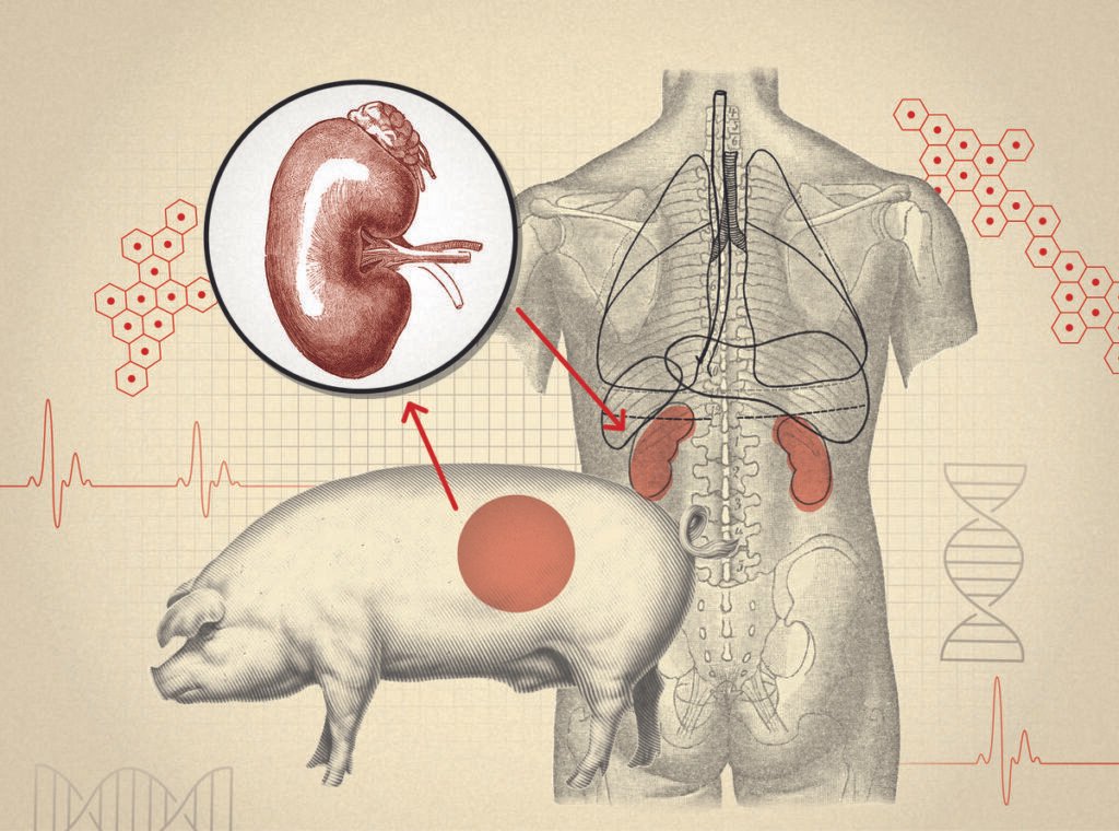 Human Kidney